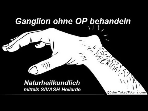 Überbein (Ganglion) ohne Operation behandeln