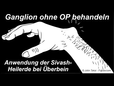 Heilerde-Anwendung bei Ganglion (Überbein)