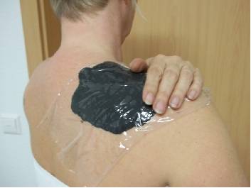 Muskelverspannungen im Schulter mit Sivash-Heilerde-Packungen lösen